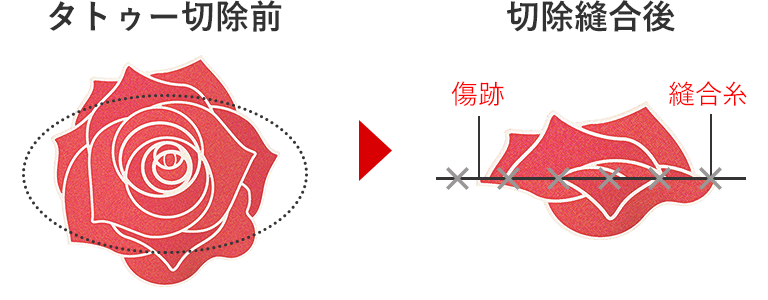 SP/施術1-1回目