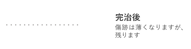 SP/施術2-2回目