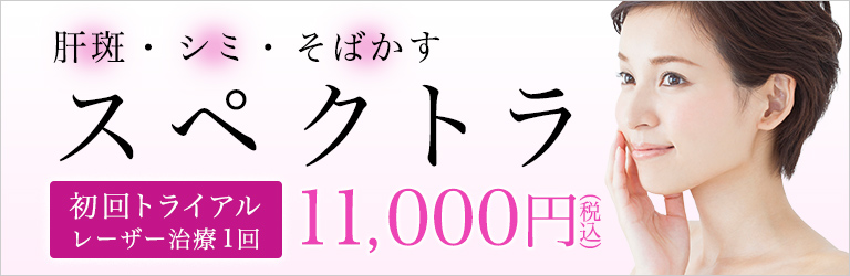 スペクトラ初回トライアル実施中